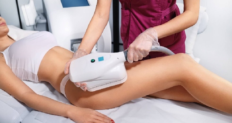 Cryolipolysis: The Cool Way to Achieve Weight Loss and Body Sculpting