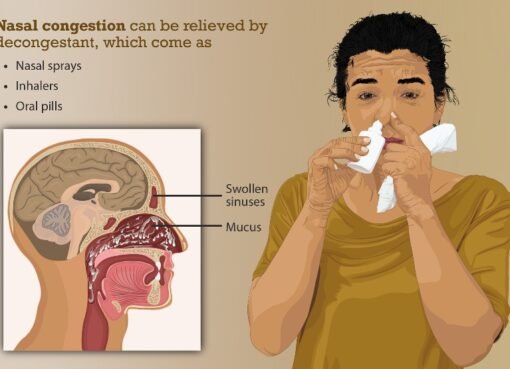 When Nasal Congestion Becomes a Concern: Understanding the Causes