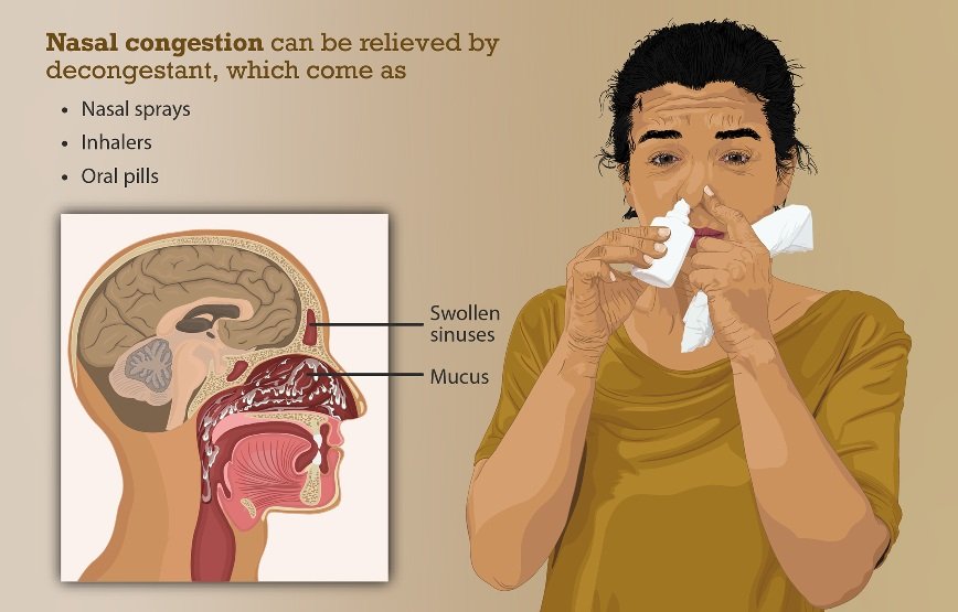 When Nasal Congestion Becomes a Concern: Understanding the Causes